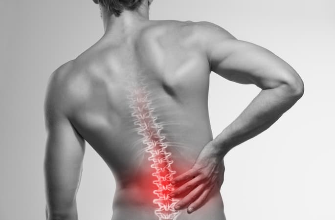 Bandscheibenvorfall LWS: Symptome, Diagnose und Behandlung